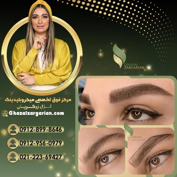 فیبروز ابرو در بهترین مرکز فیبروز ابرو