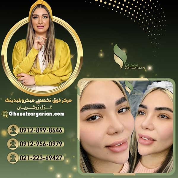 قیمت لیفت و لمینت ابرو در بهترین مرکز میکروبلیدینگ