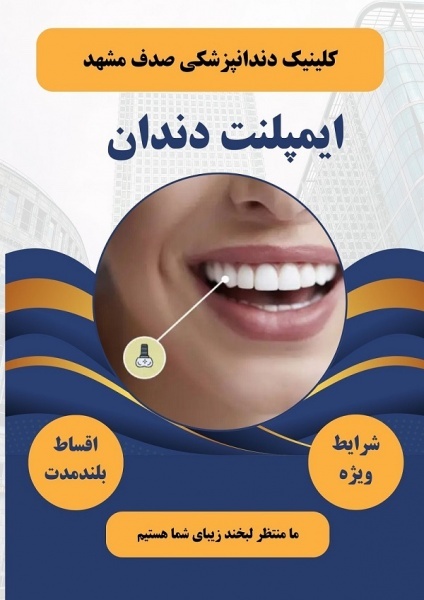 ایمپلنت دندان در مشهد با اقساط بلند مدت