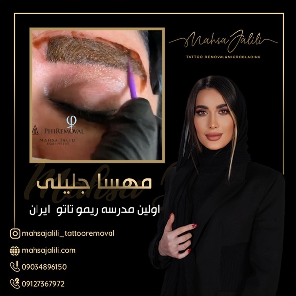 پاک کردن و ریموو تاتو بدن بدون لیزر