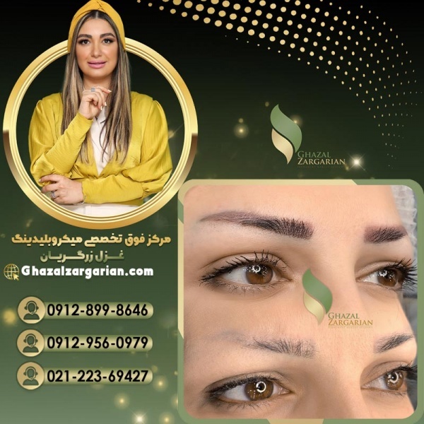 ریموو تاتو ابرو در مرکز میکروبلیدینگ غزل زرگریان