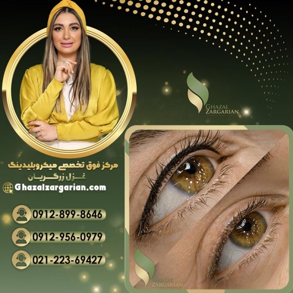 بهترین سالن برای تتوی چشم در غرب تهران