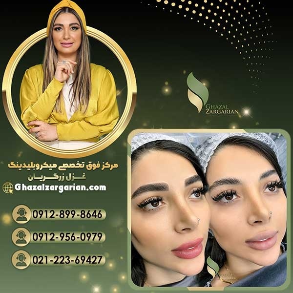 قیمت میکروپیگمنتیشن ابرو در شمال تهران